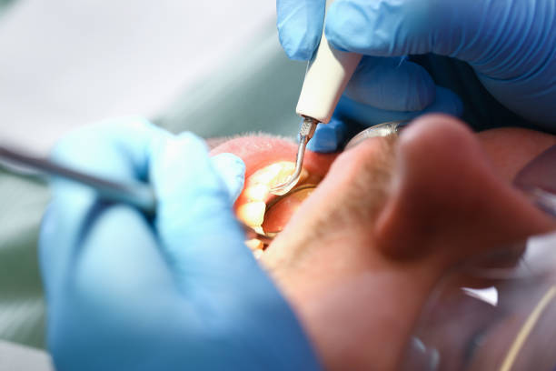 Dentist for Dental Trauma in OH