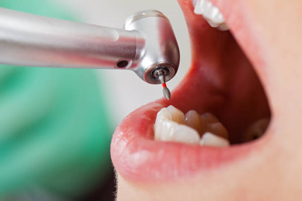 Best Emergency Gum Pain Relief  in Winchester, OH